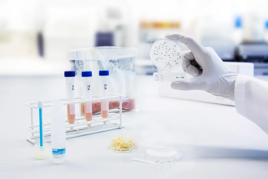 Listeria testen microbiologisch