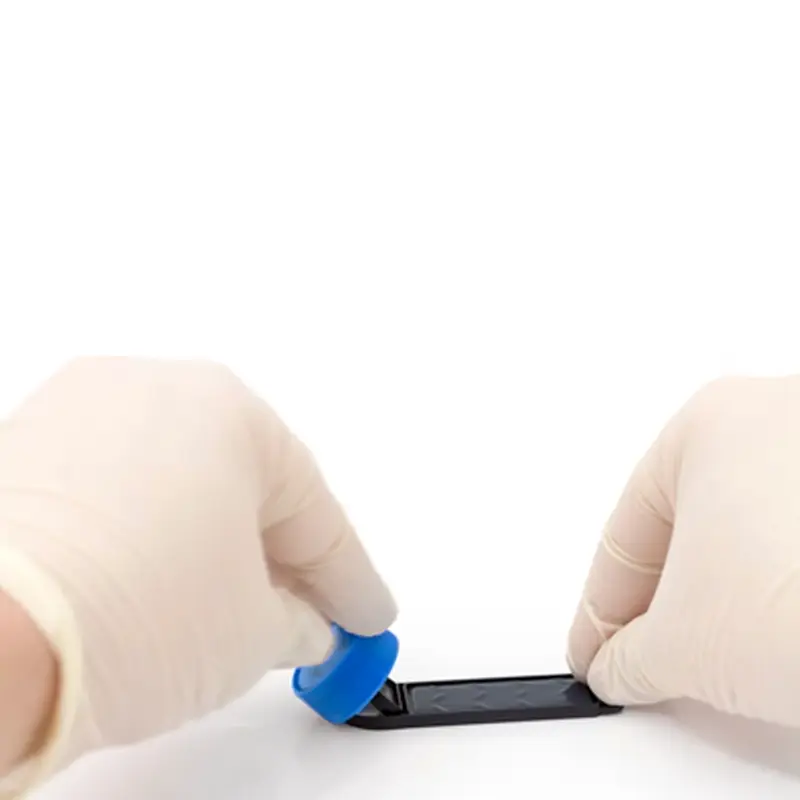 Hygicult E en ß-GUR dipslides detectie Enterobacterie en E.coli